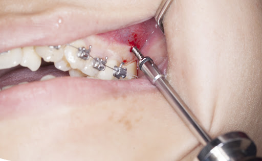 vit-chinh-nha-thai-nguyen