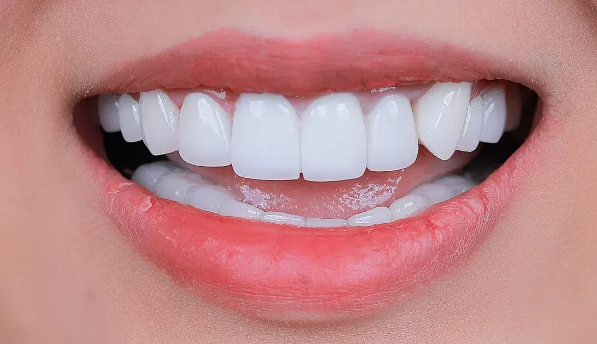 bao tiền một cái
