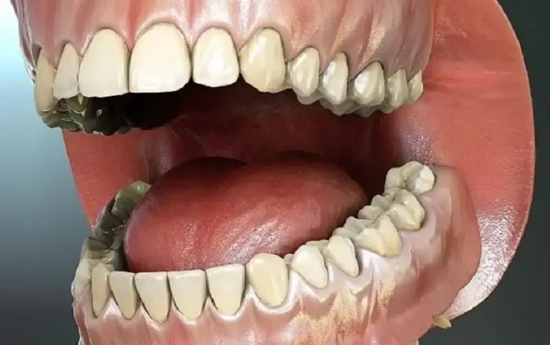 hàm răng có mấy cái